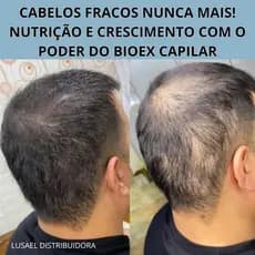 Shampoo Minox Antiqueda Crescimento rápido, controle da caspa Fortalece e Hidrata 250ml Uso Diário