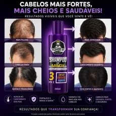 Shampoo com Minox para Cabelos Fracos Antiqueda Crescimento e Hidratação 250ml