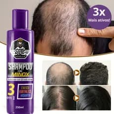 Mais Força, Menos Queda – Fortaleça Seu Cabelo da Raiz às Pontas Com O Shampoo Que Faz a Diferença!