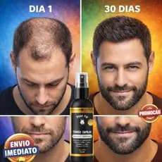 Tônico Capilar 15% Anti Queda Serum de Crescimento Poderoso Barba Cabelo Sobrancelha Bigode Kit p