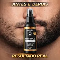 Tônico Capilar 15% Anti Queda Serum de Crescimento Poderoso Barba Cabelo Sobrancelha Bigode Kit b