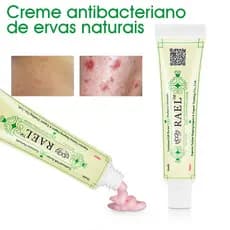 Pele Creme, Creme antibacteriano de ervas naturais, Dermatite Eczematóide Pomada Eczema Da Cuidados Com A Fungos Inibição Alívio Coceira Vermelho Erupa