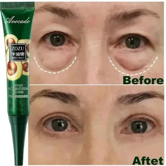 Creme Para Remoção Instantânea De Rugas Os Olhos Anti-Pouch Eye Ring Puffiness Light Hairline Eliminar O Clareamento Sob A Coréia Do Sul Cuidados Com Pele