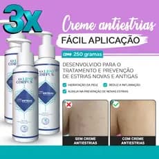 Creme AntiEstrias Remove e Previne Tratamento Avançado Ação Poderosa - 250g Lipo Corpus Original