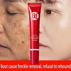 Poderoso creme exclusivo para remoção de sardas, remove manchas escuras/colore calmante/cuidado da pele B8V3 0271