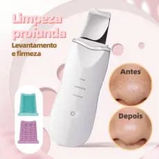 Aparelho Removedor de Cravos Ultrassônico Peeling Facial Profissional Limpeza de Pele Profunda Antirrugas Espátula