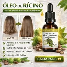 Óleo de Rícino Puro 100% 30ml Crescimento Capilar, Barba, Sobrancelha e Cílios Fortalece os Fios