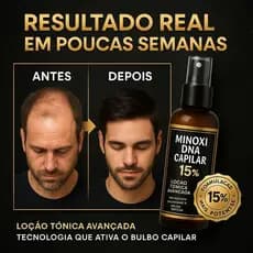 Tônico Capilar 15% Anti Queda Serum de Crescimento Poderoso Barba Cabelo Sobrancelha Bigode Kit y