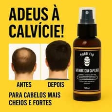 Tônico Capilar 15% Anti Queda Serum de Crescimento Poderoso Barba Cabelo Sobrancelha Bigode Kit c