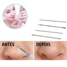 Kit 4 Agulhas Extrator Removedor Tira Acne Cravos Espremedor Espinha Poros. Manicura Salão de Beleza
