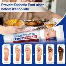 Creme Tangning Foot Care Alivia Pele Seca , Rachada E Coceira Nos Pés