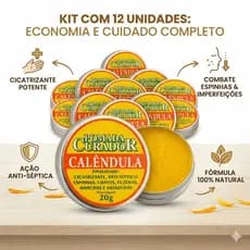Kit 12 Pomada De Calêndula Curador 20g Original - Cicatrizante Natural Para Espinhas, Manchas, Assaduras e Cuidados Com
