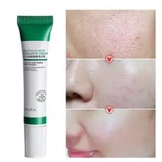 20 ml para remover buracos/acne e clareamento/brilho/creme de ácido salicílico para controle de óleo/