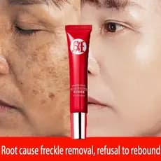Creme forte original para remover manchas escuras/clareamento pigmentado/cuidados com a pele QRJZ