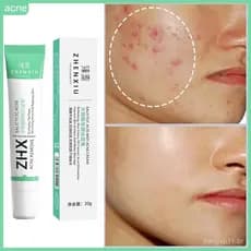 Creme Facial Anti-Acne com Ácido Salicílico para Remover Oleosidade e Cravos, Clareamento de Cicatrizes