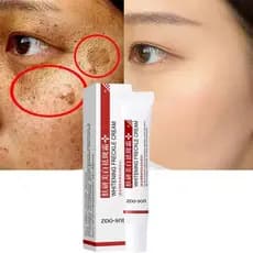 Creme clareador, usado para remover manchas/escuridões/melanina/brilho