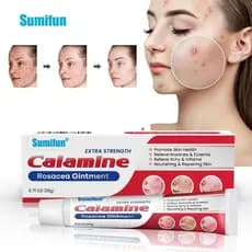 Pomada de Calamina 20g para Rosácea, Creme Calmante Extra Forte para Reparação de Acne, Tratamento de Pele 70EH VLO4