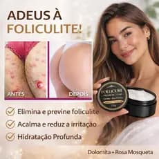 Follicure Premium Clear Anti-Foliculite 150g Elimina Pelos Encravados/Clareia Axilas/Virilha e Glúteos