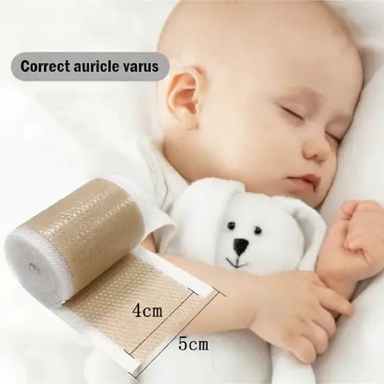Fita De Silicone Corretora De Orelha De Bebê Para Correção Infantil