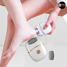 Lixadeira Elétrica Para Pés Com Velocidade Ajustável : Remove Calos , Pele Morta E Unhas De Limão Sem Umidade