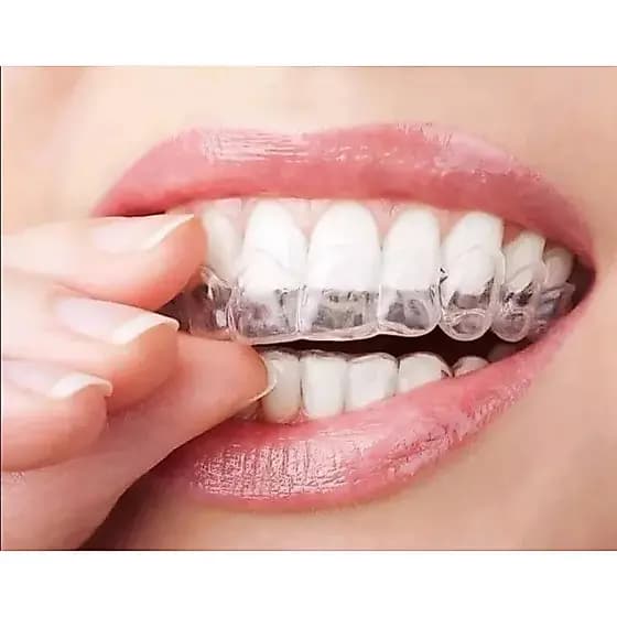 Kit Placa Bucal De Silicone Ajustável Moldagem Em Água Quente Uso Diário E Noturno