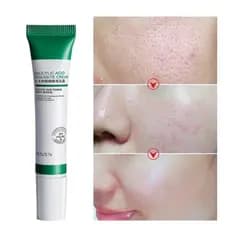 Creme com Ácido Salicílico – 20 g– Indicado para peles oleosas e mistas