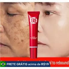 Creme forte original para remover manchas escuras/clareamento pigmentado/cuidados com a pele