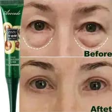 Creme Instantâneo Antirrugas Para Os Olhos , anti-Olheiras , Bolsas E Produtos Inchados Cuidados Com A Pele .