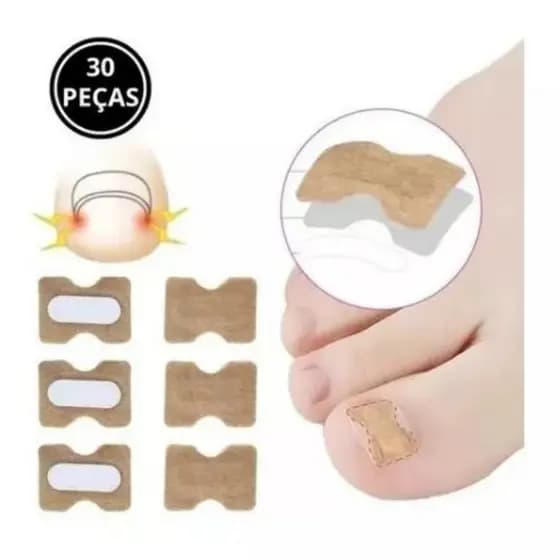 Kit 30 Adesivos Órtose Correção Unha Encravada Saúde Dedo