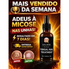ACABE COM A MICOSE NAS UNHAS RÁPIDO! TRATAMENTO PODEROSO ANTI-FUNGOS + RESULTADOS VISÍVEIS EM DIAS PRETA 30 ml
