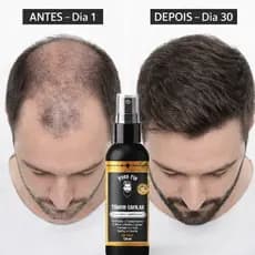 Tônico Capilar 15% Anti Queda Serum de Crescimento Poderoso Barba Cabelo Sobrancelha Bigode Kit f