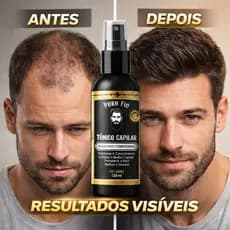 Tônico Capilar 15% Anti Queda Serum de Crescimento Poderoso Barba Cabelo Sobrancelha Bigode Kit e