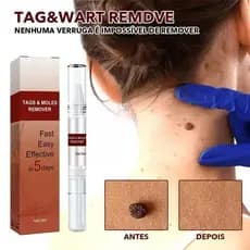Removedor De Marcas De Pele Em Gel Líquido Macio Natural Não Irritante Fácil De Remover Para Rosto