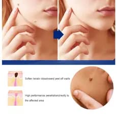 Gel hidratante natural Creme para remoção de manchas Suave para a pele, fácil de remover, adequado para uso facial