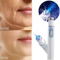 Caneta Led 45nm Luz Azul Acne Terapia Cicatriz Mancha Rugas