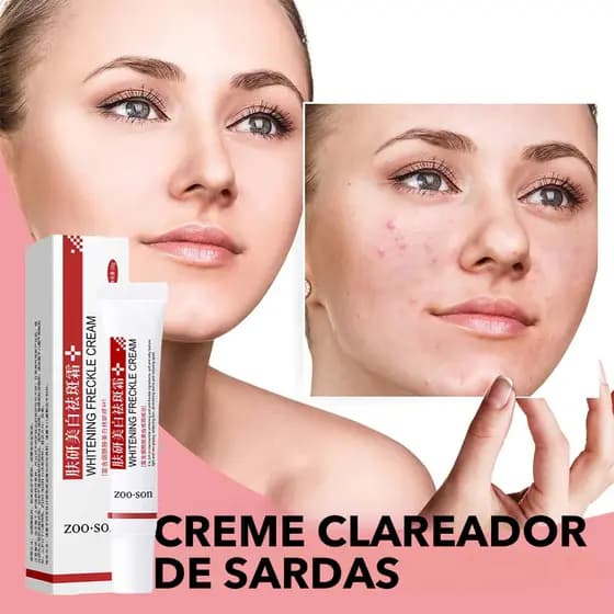 Creme Clareador Para Remover Melasma/Melanina/Removedor De Pele Brilhante Creme Clareador Facial