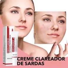 Creme Clareador Para Remover Melasma/Melanina/Removedor De Pele Brilhante Creme Clareador Facial
