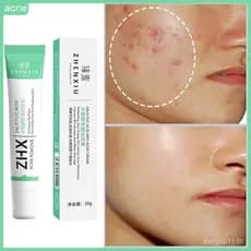 Creme Facial Anti-Acne com Ácido Salicílico para Remover Oleosidade e Cravos, Clareamento de Cicatrizes
