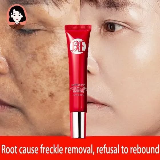 Creme original forte para remoção de manchas escuras/pigmentação clarificada/cuidados com a pele