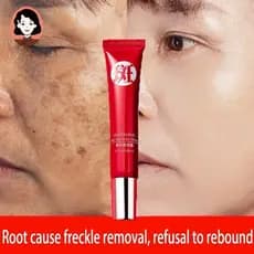 Creme original forte para remoção de manchas escuras/pigmentação clarificada/cuidados com a pele