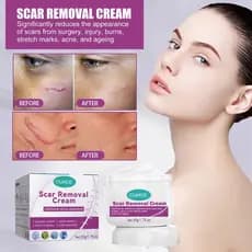 Creme Eliminar Cicatrizes Pretas Remover Feridas Antigas Picada de Mosquito Cicatriz Quelóide Queimaduras Scal -beleza