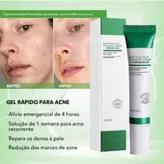 20ml Creme De Ácido Salcílico Para Remoção De Poros/Acne E Clareamento Acnes/Clareamentos/Antiridade/Controle De Óleo