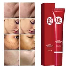 Creme Forte Original para Remover Manchas Escuras/Clareamento Pigmentado/Cuidados com a pele