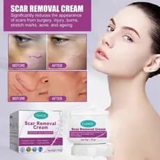 Creme Eliminar Cicatrizes Pretas Remover Feridas Antigas Picada de Mosquito Cicatriz Quelóide Queimaduras Scal -beleza
