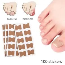 100 Unidades Adesivo Para Fungos Nas Unhas Pegajoso Reparo De Correção Encravada Cuidados Com As Paroníquia Reme