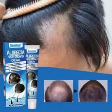 Alopecia Areatta Care Creme Alcaçuz Regeneração Reparação Prevenindo Perda De Cabelo Calvície Linha Alta Fina Aume