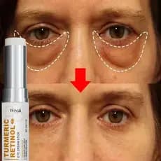 Saco De Olho Instantâneo Remover Creme Para Os Olhos Anti Partículas De Gordura Olheiras Inchaço Desbotamento Linhas Fin