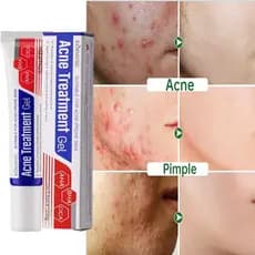 Creme De Remoção De Acne Anti-Reparação Vermelhidão Manchas De Espinha Gel Limpeza Profunda Poros Controle De Óleo Hidra