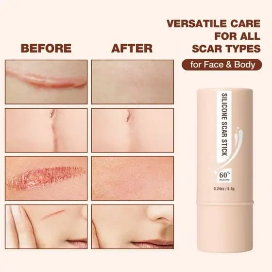 【Oferta Limitada】Bastão Reparador Centella Asiática Vitamina E | Regenera Pele | Melhora Marcas e Estrias | Rosto Corpo