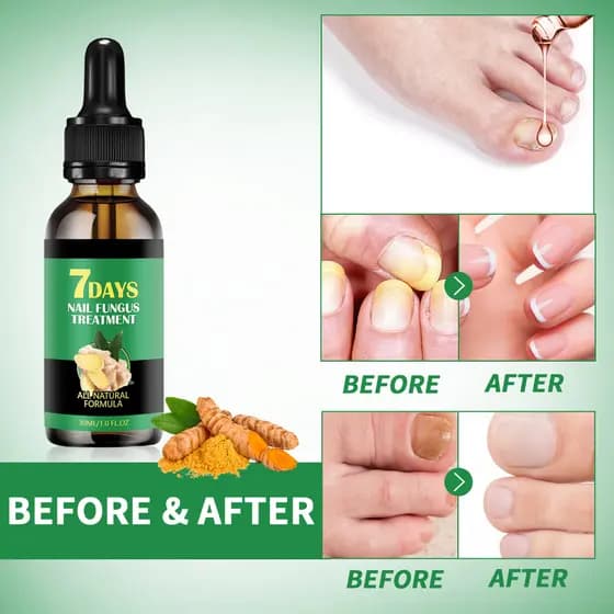 SOS Sérum Reparador Unhas Gengibre | Fortalece Previne Quebras Repara Danificadas Cutículas Brilho Endurece Nutrição